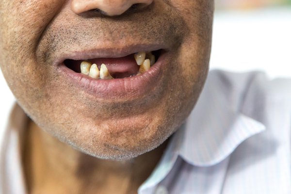 Chimuelo | Spanish to English Translation - SpanishDictionary.com