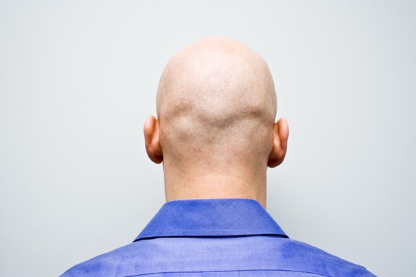 Bald | Traductor de inglés a español - inglés.com