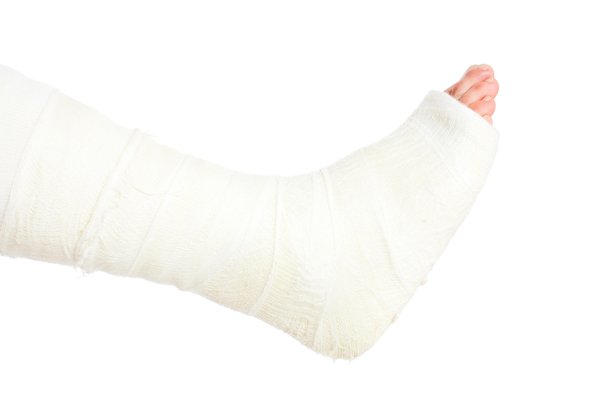 I Broke My Leg In Spanish English To Spanish Translation 