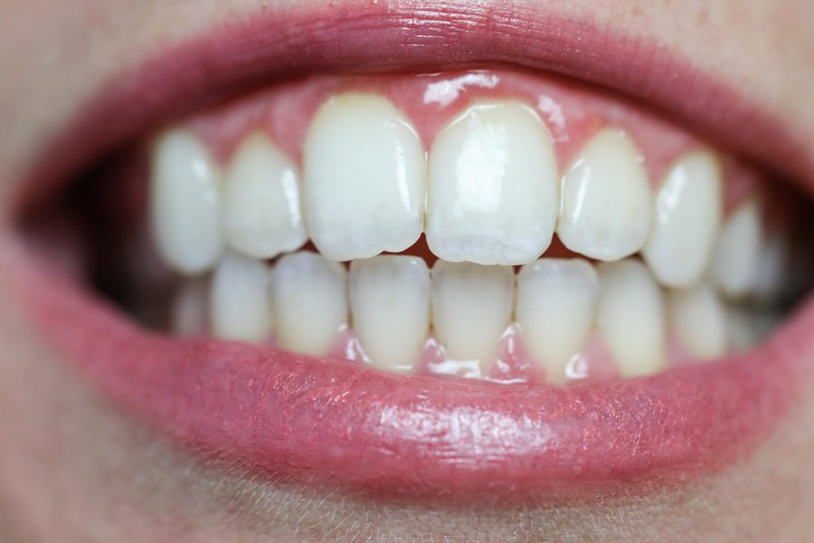 Dentadura en inglés Traductor de español a inglés