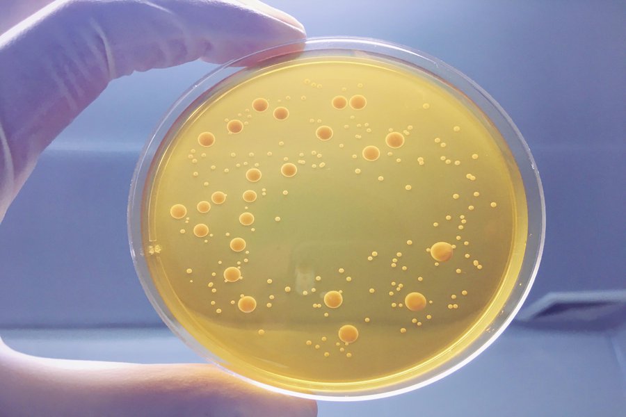 Bacteria Spanish to English Translation