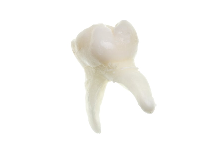 Muela en inglés | Traductor de español a inglés - inglés.com