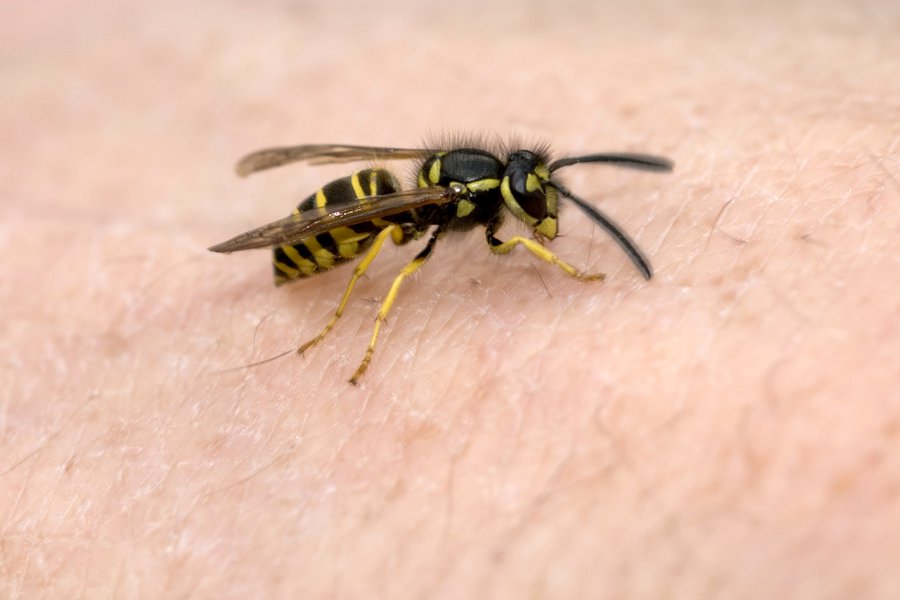 Sting in Spanish English to Spanish Translation